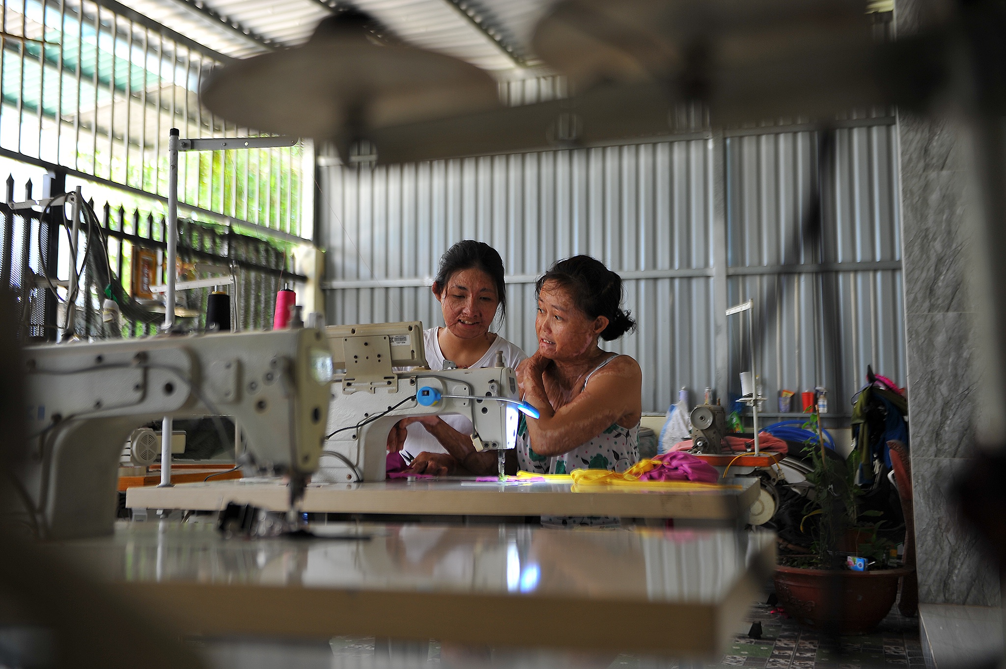 vo bi chong tuoi xang dot anh 21