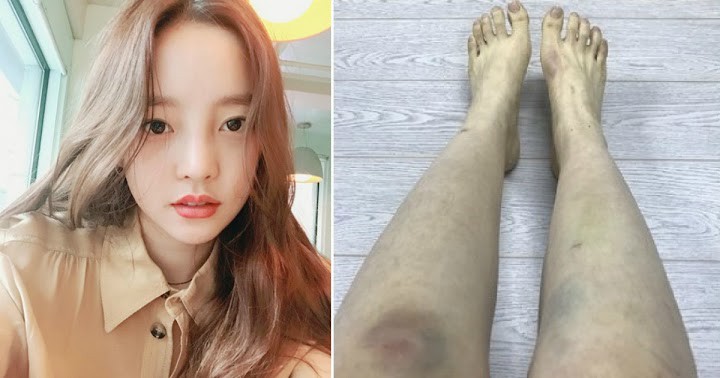 Toi ac tinh duc co bi trung phat sau cai chet cua Sulli, Goo Hara? hinh anh 4