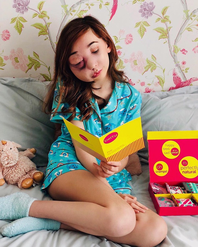 Co gai 'quai vat' tro thanh niem tu hao cua nuoc Anh hinh anh 4 n14.jpg