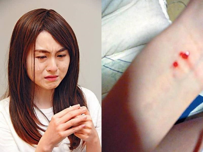 Nu ca si Hong Kong bi quan ly ep lam no le tinh duc suot 2 nam hinh anh 1