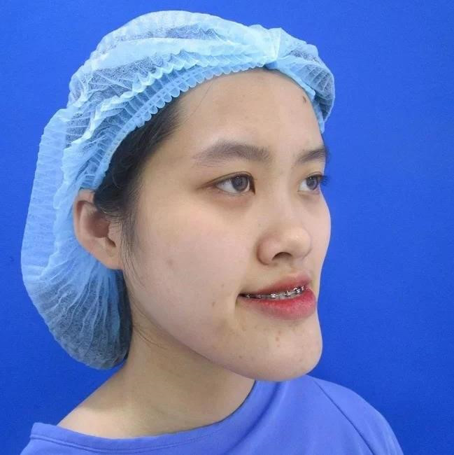 Nu sinh Canh sat va cac co gai 'lot xac' sau khi phau thuat tham my hinh anh 1