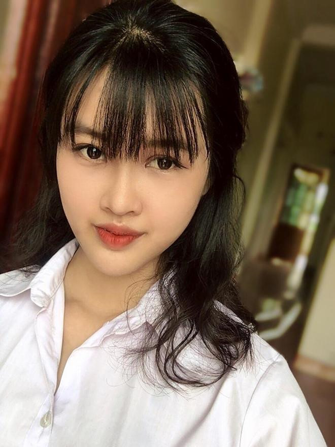 Nu sinh Canh sat va cac co gai 'lot xac' sau khi phau thuat tham my hinh anh 3