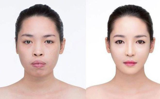 Nu sinh Canh sat va cac co gai 'lot xac' sau khi phau thuat tham my hinh anh 5