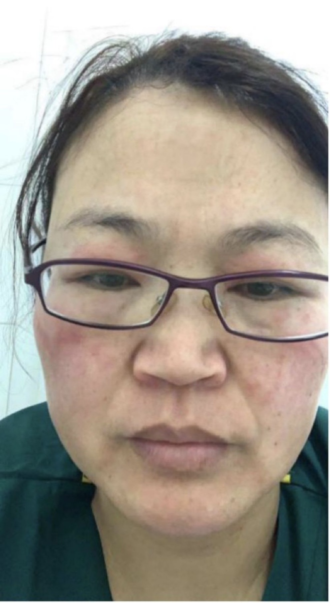 Bac si Vu Han mat han khau trang, dau cao troc vi chong dich corona hinh anh 8 925.jpg