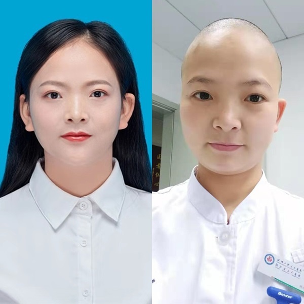 Bac si Vu Han mat han khau trang, dau cao troc vi chong dich corona hinh anh 2 nu_y_ta_o_tam_bao_dich_benh_vu_han_da_cao_mai_toc_dai_bat_ngo_voi_muc_dich_sau_do.jpg