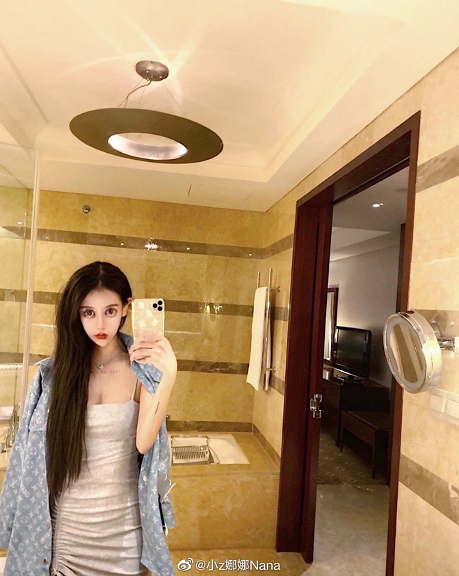 Guong mat bien dang cua 10X phau thuat tham my 60 lan tu nam 13 tuoi hinh anh 2 86e94dd8ly1gc4gr7xo2tj20u011pqb7.jpg