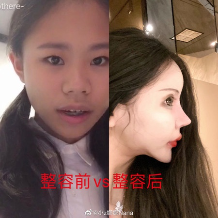 Guong mat bien dang cua 10X phau thuat tham my 60 lan tu nam 13 tuoi hinh anh 6 d4730968.jpg