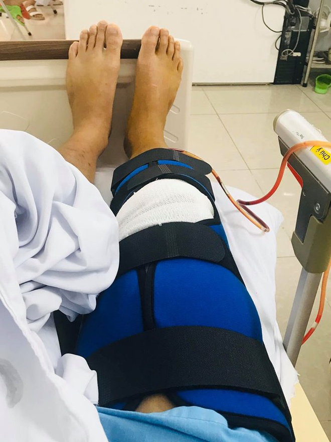 Thanh Duy nga cau thang, bi dut day chang dau goi hinh anh 2 96373812_293556021641216_2539785316571545600_o.jpg