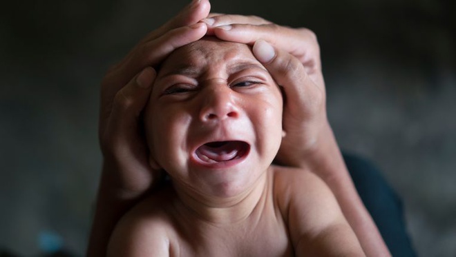 Nhung bien chung nghiem trong cua virus gay benh dau nho hinh anh 2 virus_zika_1.jpg