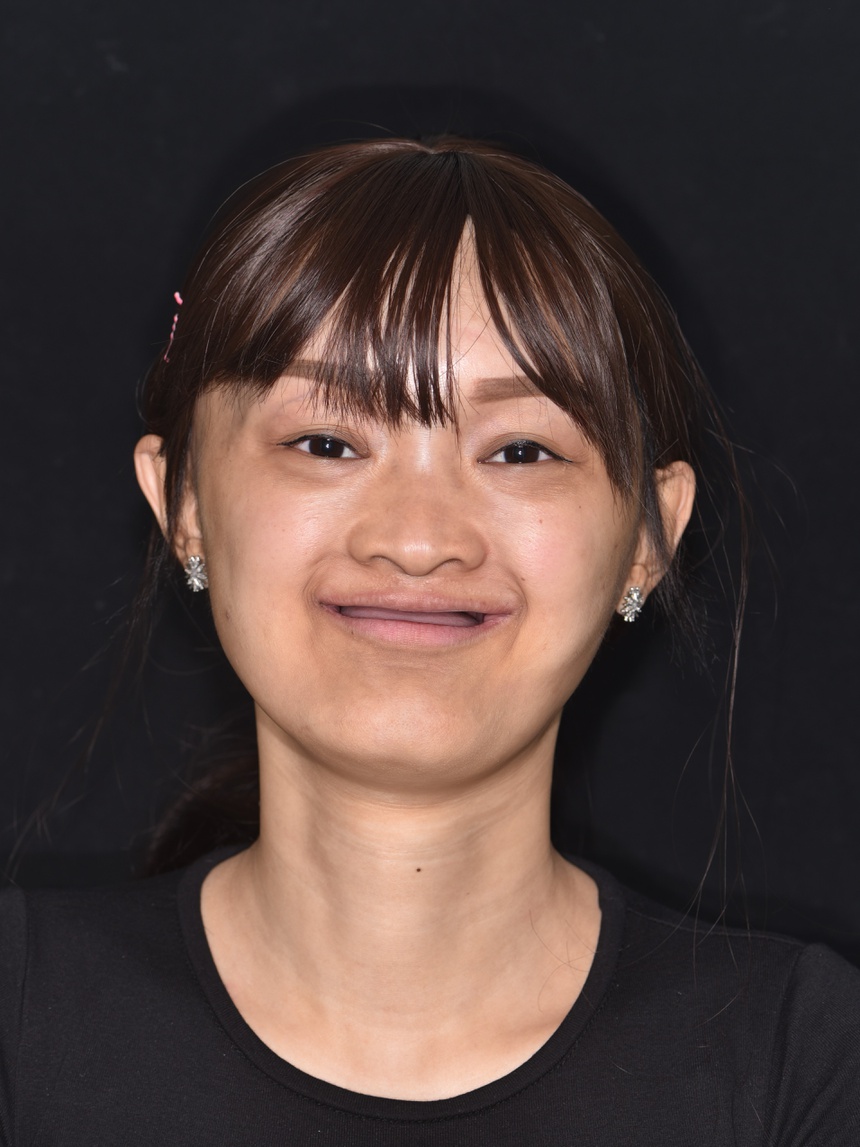 Co gai khong rang bam sinh anh 1