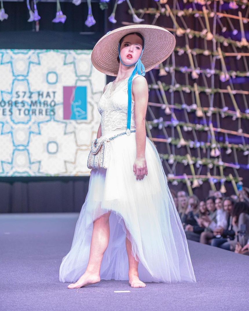 nguoi mau mac hoi chung down anh 3