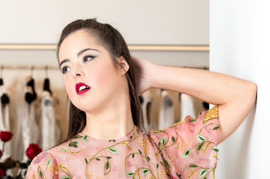 nguoi mau mac hoi chung down anh 1